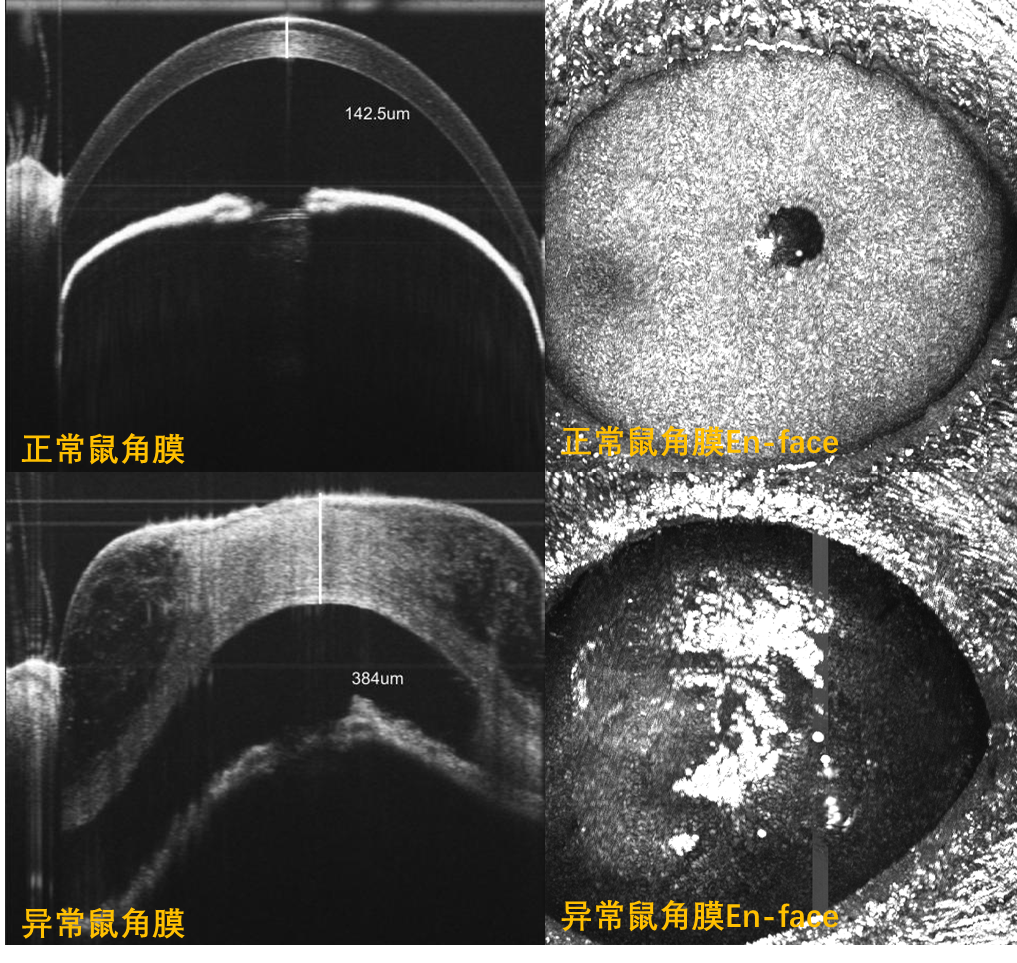 眼科超显微成像系统