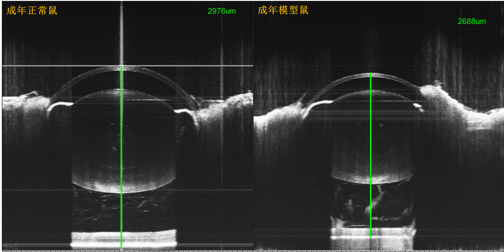 眼科超顯微成像系統(tǒng)